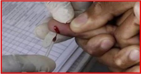 Recette Facile | Voici comment sauver une personne d’un AVC en utilisant JUSTE une Aiguille …